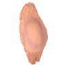 Plaie Filet Fracture